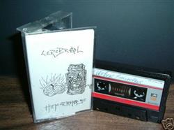 Download Cerebral Hemorrhage - Cerebral Hemorrhage