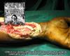 lataa albumi MxOxPxCxBxIxTxIxLxOxTxBxVx - Surgical Debridement Of Left Upper Limb Showing Complete Loss Of Flexor Comparment Tendons