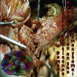 Download Acute Necrotizing Pancreatitis - Pheochromocytoma Repercussion On The Organs And Tissues demo2